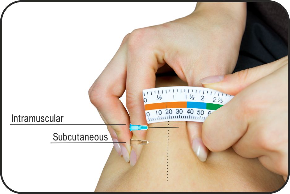 Expanded Needle And Syringe Guide Union Medico