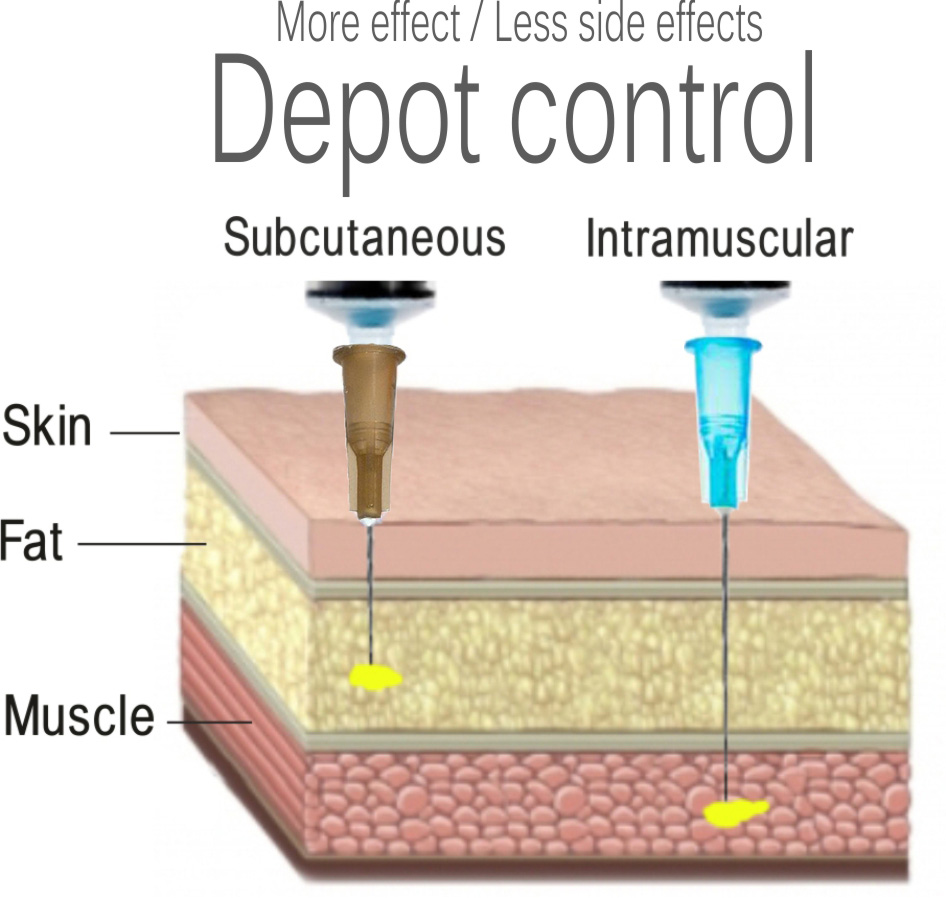 Im Injection Sites Needle Size